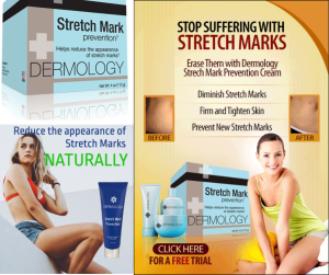 Unveiling the Dermology Stretch Mark Prevention Cream