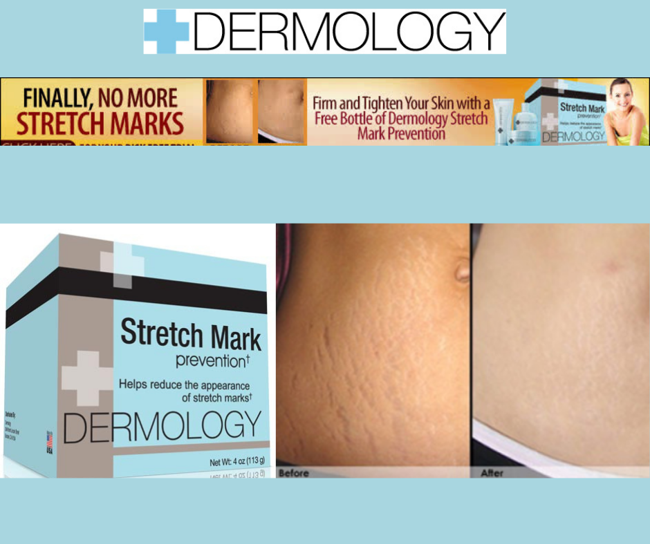 Mometry Cream Unveiling the Dermology Stretch Mark Prevention Cream