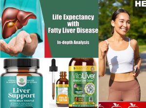 Life Expectancy with Fatty Liver Disease