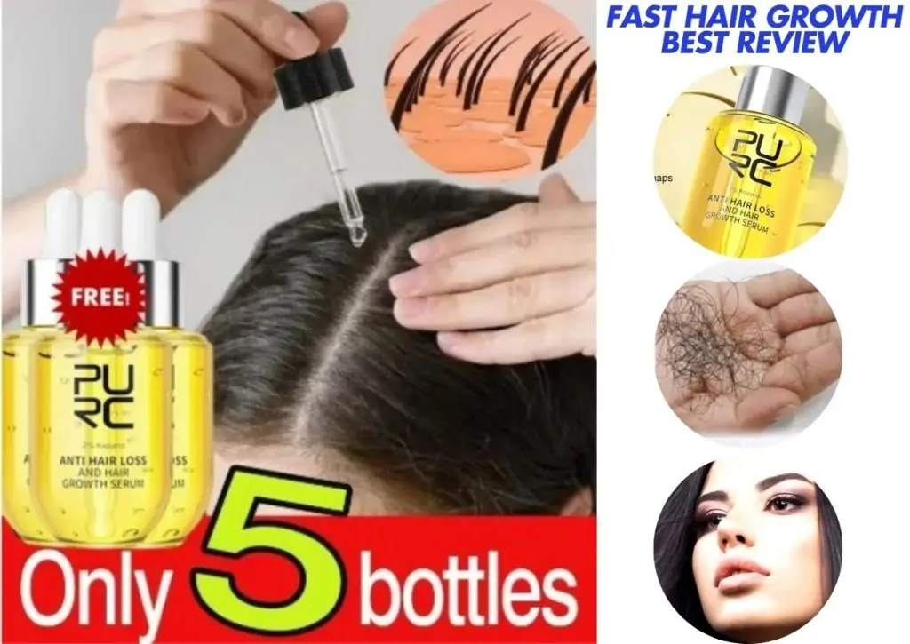Fast Hair Growth Best Review