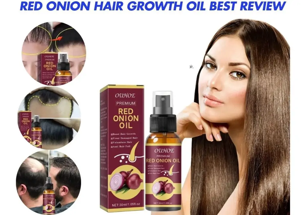 RED ONION Hair Growth Oil Best Review