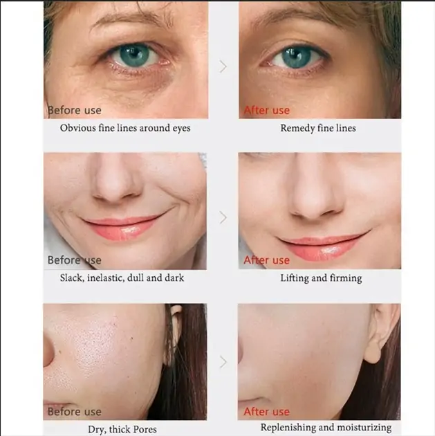 Guide to Retinol Wrinkle Remover Face Set