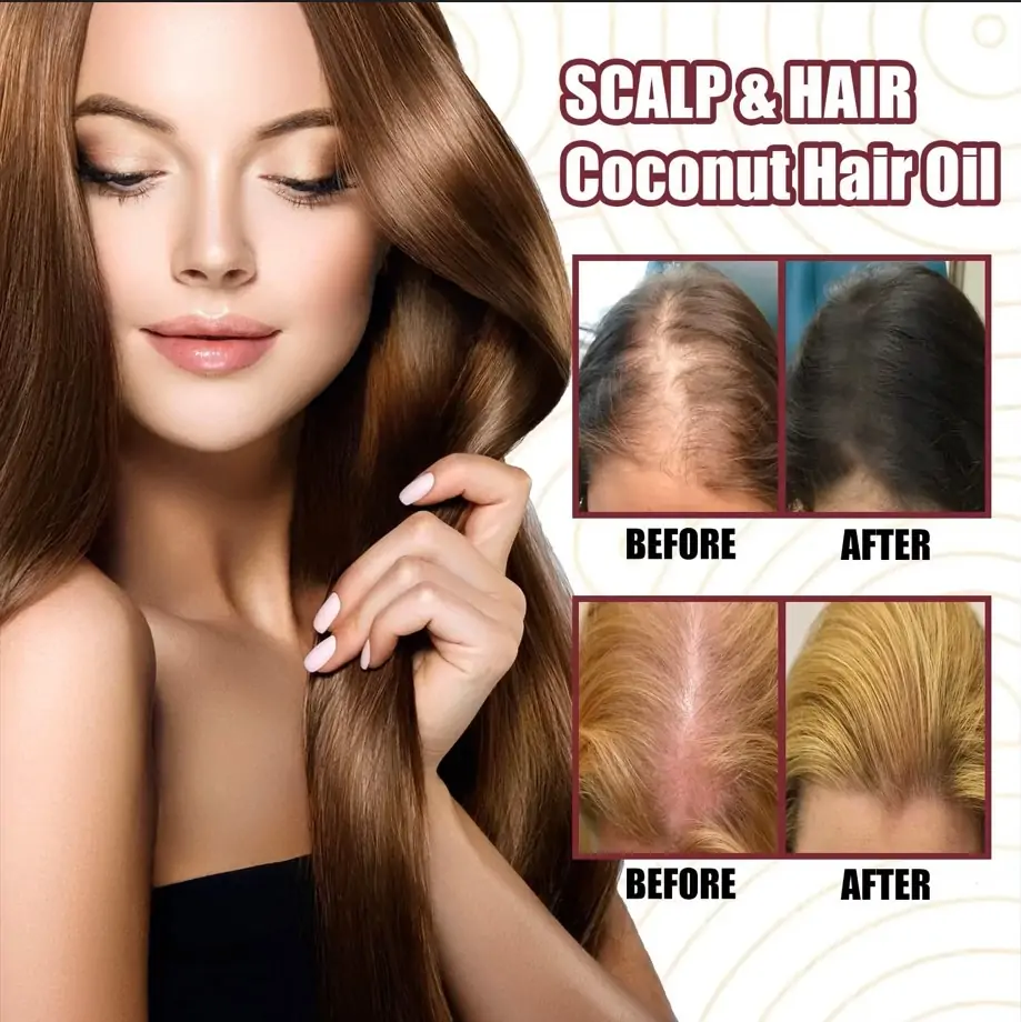 RED ONION Hair Growth Oil Best Review: Powerful Hair Growth Serum Spray 2 RED ONION Hair Growth Oil Best Review