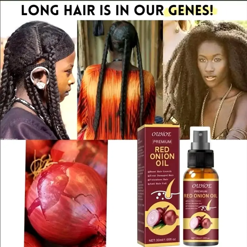 RED ONION Hair Growth Oil Best Review: Powerful Hair Growth Serum Spray 3 RED ONION Hair Growth Oil Best Review