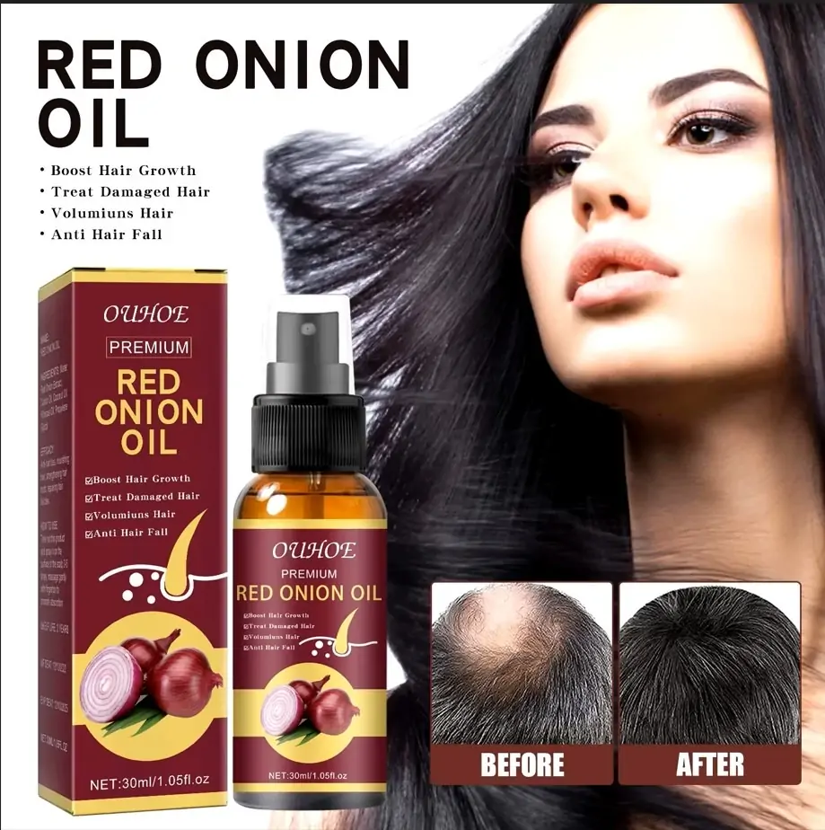 RED ONION Hair Growth Oil Best Review: Powerful Hair Growth Serum Spray 9 RED ONION Hair Growth Oil Best Review
