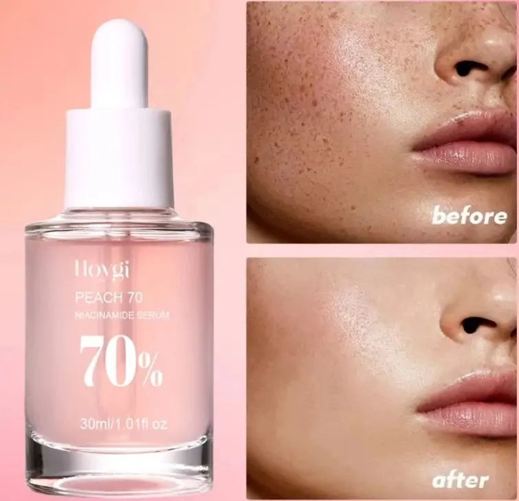 Peach 70% Niacinamide Serum Review