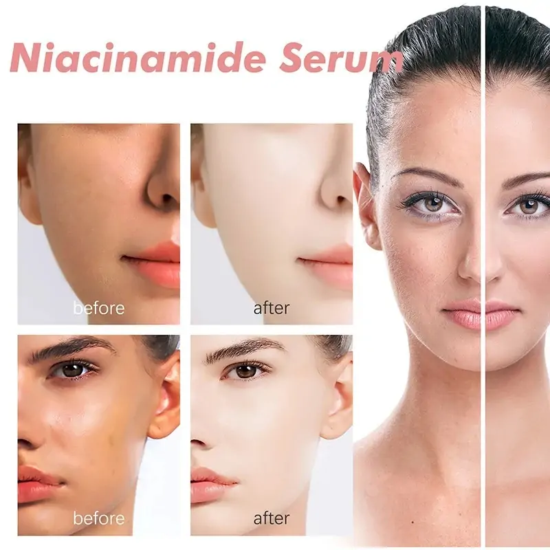 Peach 70% Niacinamide Serum Review
