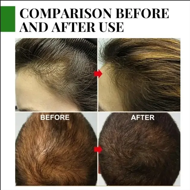 Rosemary Essential Hair Growth Oils Review