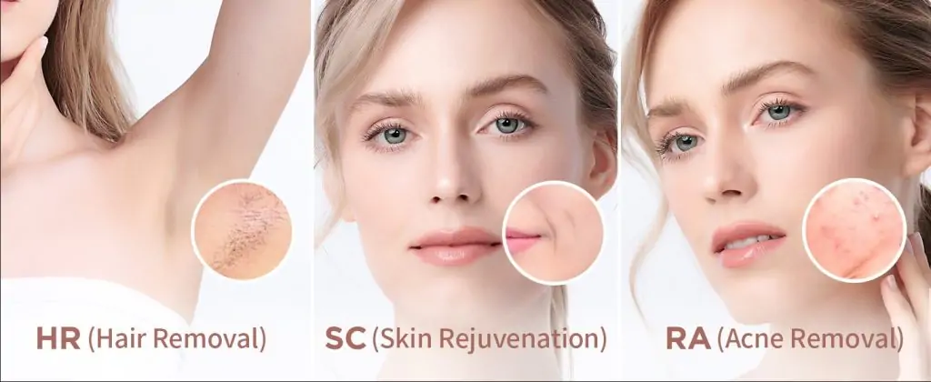 IPL Hair Removal Laser Device Review: Smooth Skin in Just 4 Weeks at Home 4 IPL Hair Removal Laser Device Review