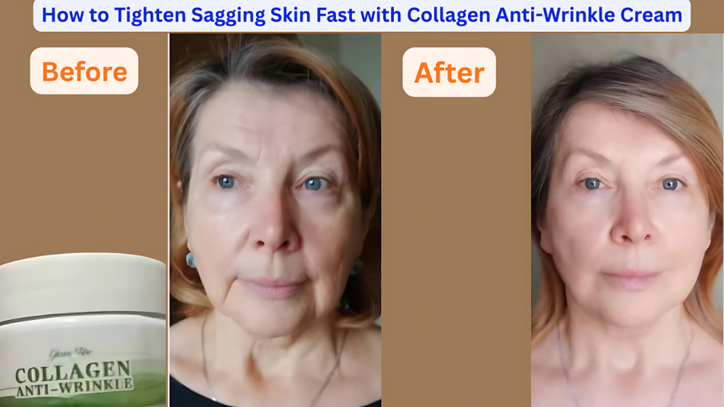Collagen Anti-Wrinkle Cream: How to Tighten Sagging Skin Fast 7 Collagen Anti-Wrinkle Cream
