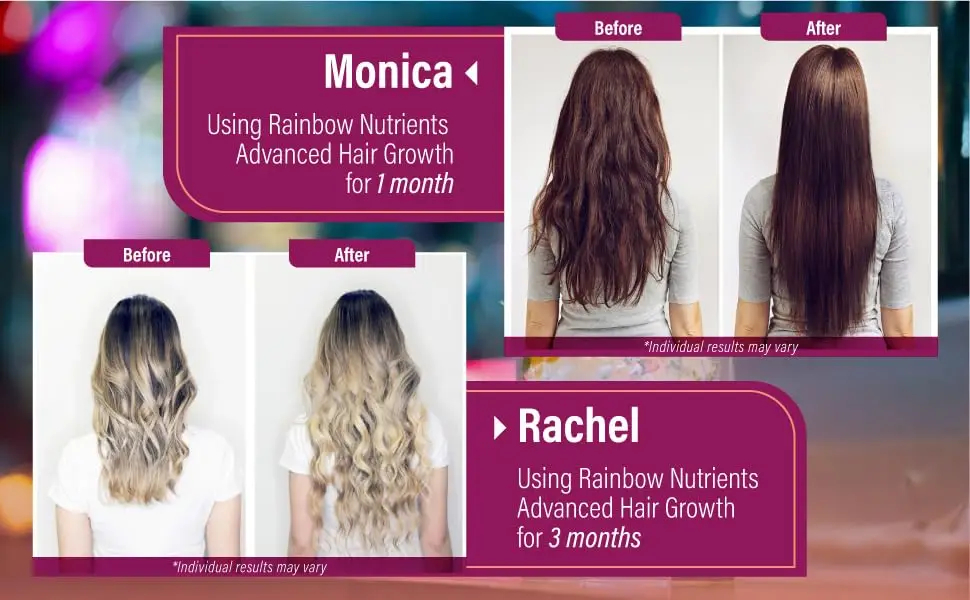 Xemenry Hair Growth Vitamins