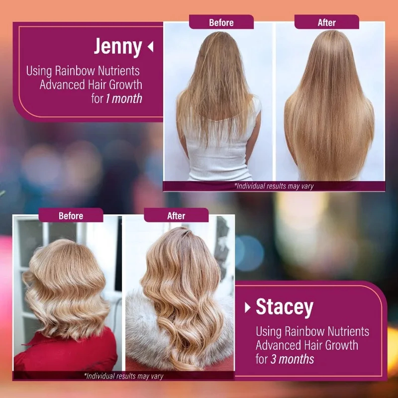 Xemenry Hair Growth Vitamins