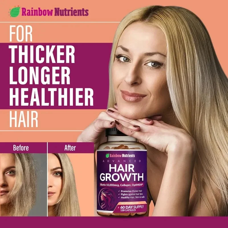 Xemenry Hair Growth Vitamins