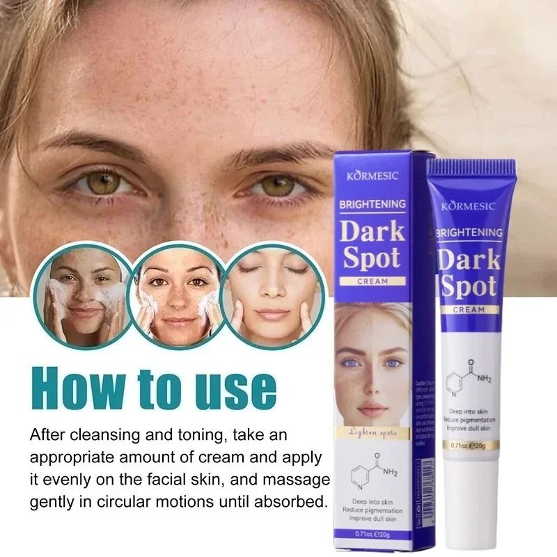 Dark Spots Removal Cream Review: The Ultimate Solution for Facial Whitening, Freckle, and Acne Mark Correction 9 Dark Spots Removal Cream Review