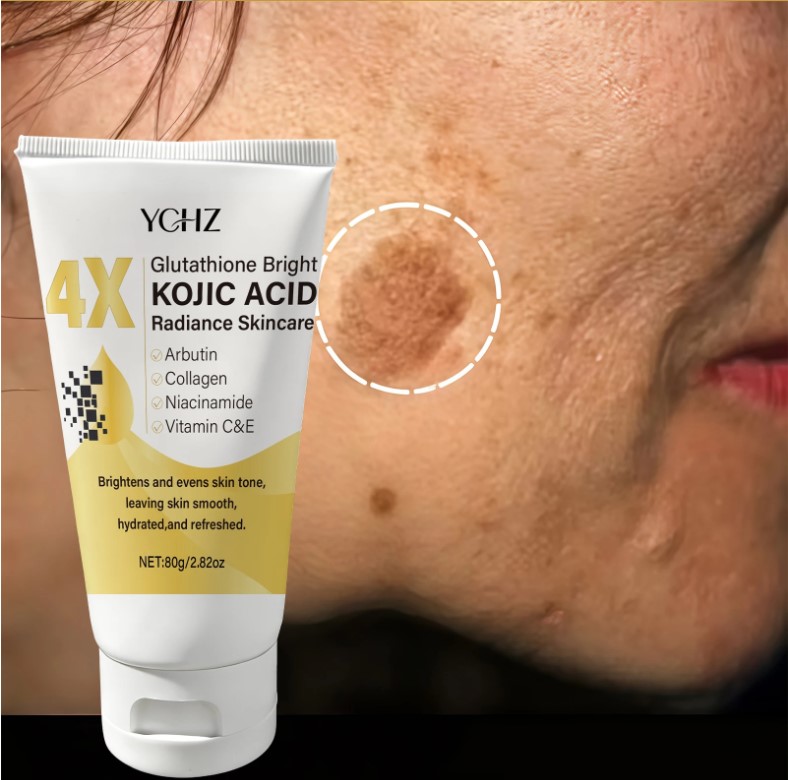 Kojic Acid Face Cream Review: How to Clear Dark Spots 6 Kojic Acid Face Cream Review